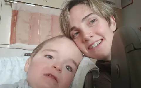 Un bambino con sindrome di down lieve e sua madre sorridono. La sua espressione dolce e i suoi occhi chiari sono un segno di amore.